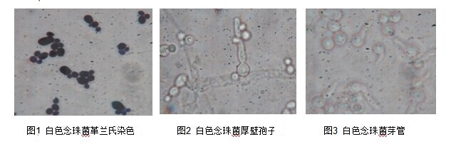 白色念珠菌 白色念珠菌