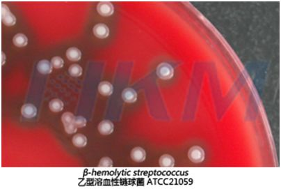 乙型溶血性鏈球菌 乙型溶血性鏈球菌