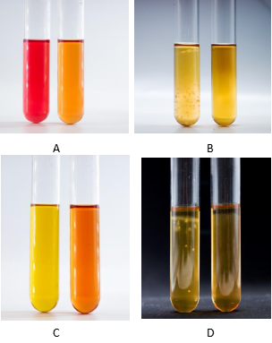支原體培養(yǎng)基陽(yáng)性案例展示