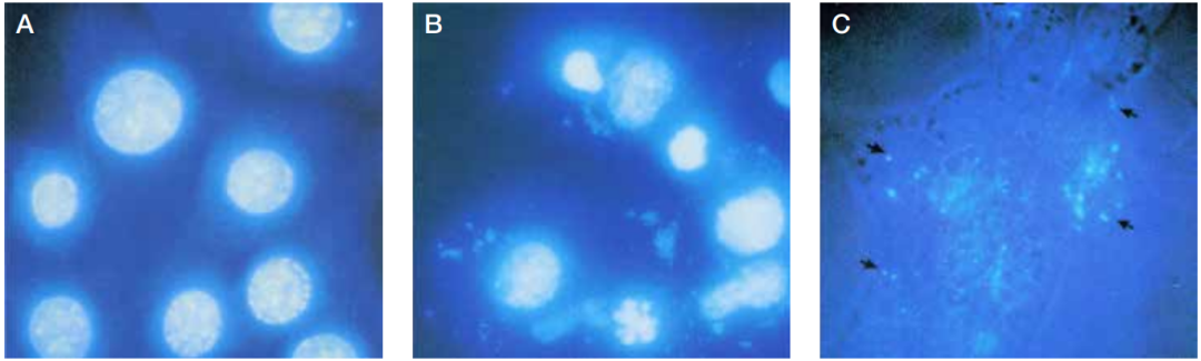 生物污染物-支原體