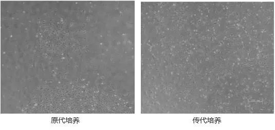 原代細胞和傳代細胞的區(qū)別