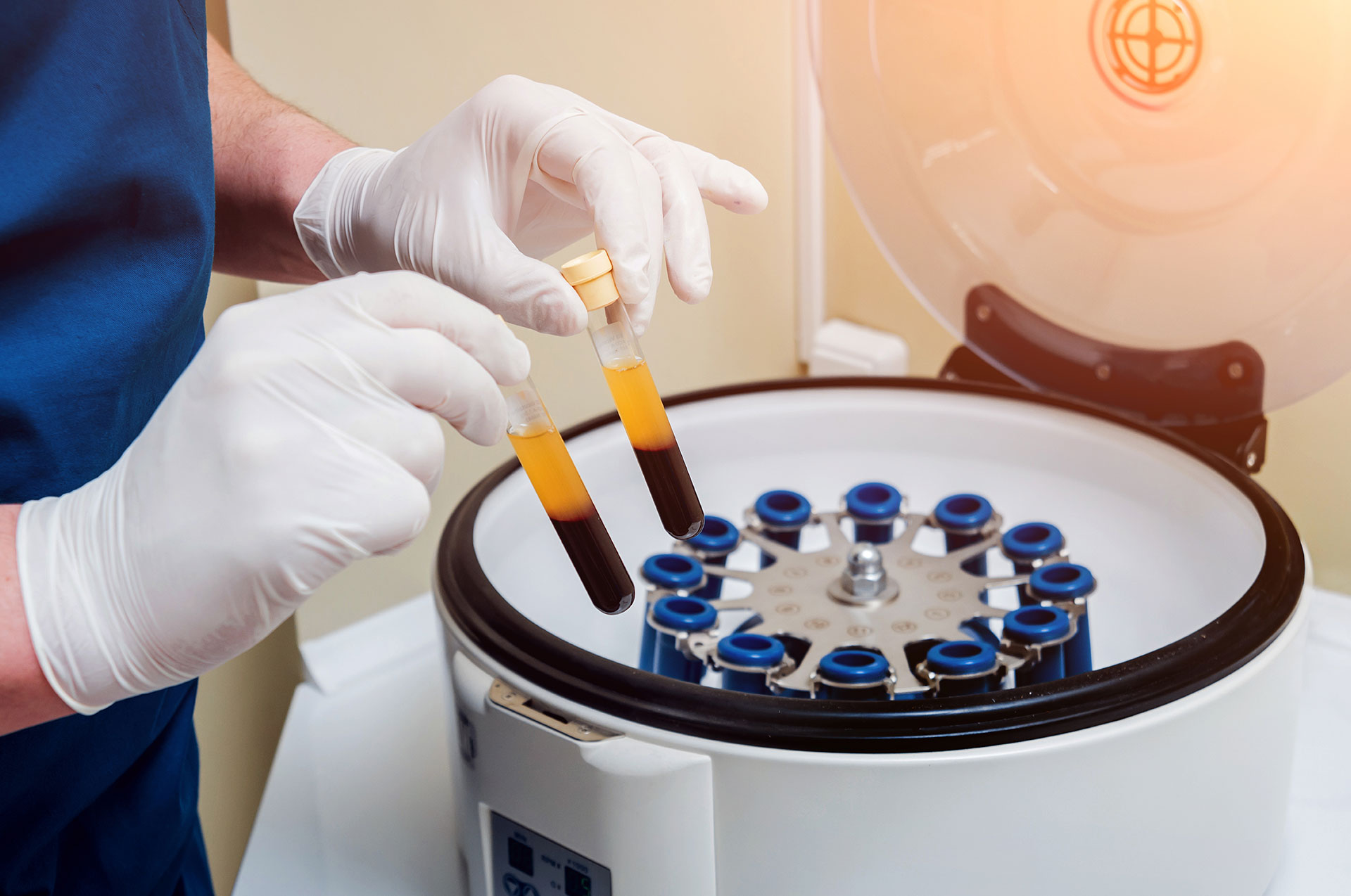 血清的保存解凍 血清的保存解凍