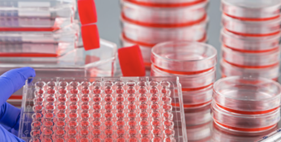 細(xì)胞培養(yǎng)器皿