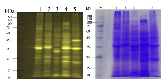 免染凝膠成像與考馬斯亮藍(lán)染色對比圖
