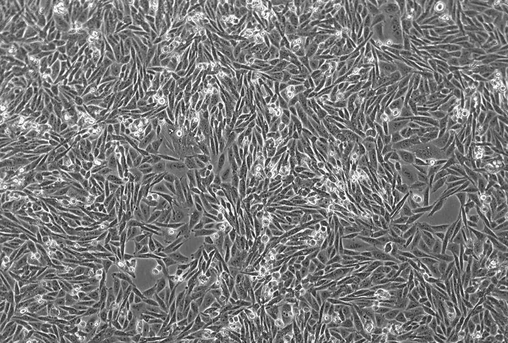 中國倉鼠卵巢（CHO）細胞
