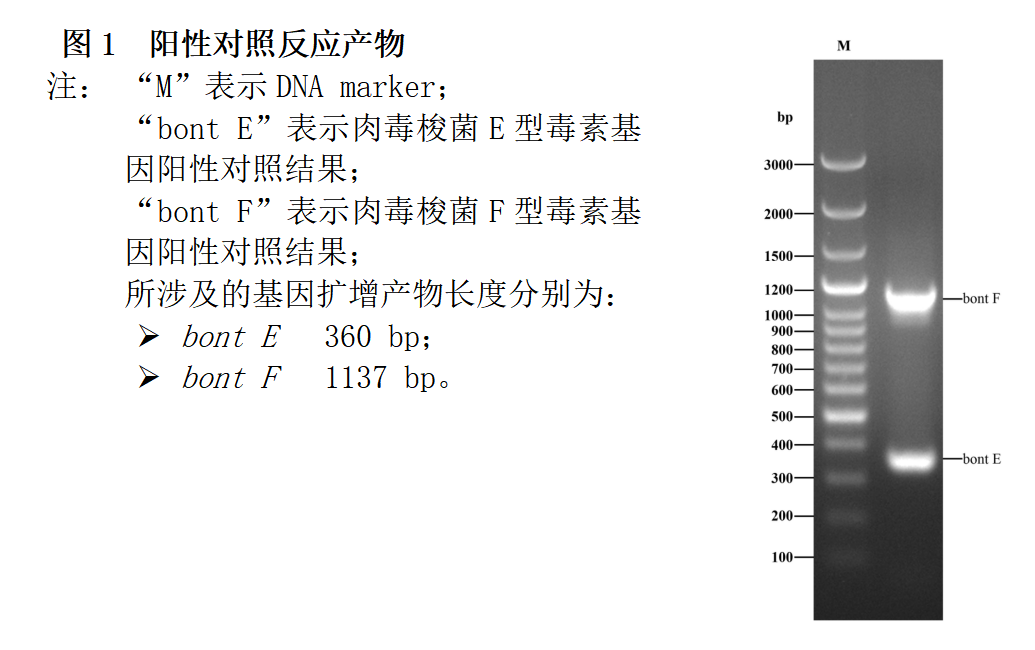肉毒梭菌E/F型毒素基因PCR檢測(cè)試劑盒結(jié)果判讀 肉毒梭菌E/F型毒素基因PCR檢測(cè)試劑盒結(jié)果判讀